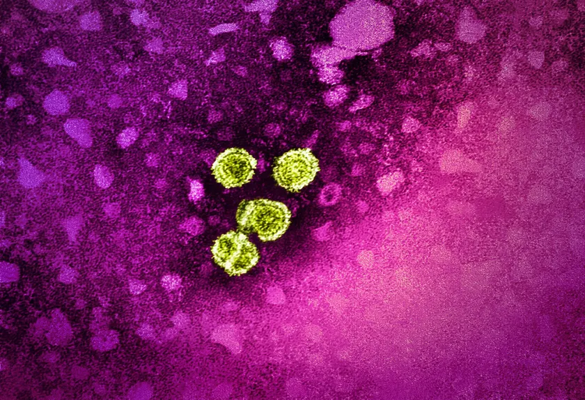 A colorized micrograph of round hepatitis B virus particles against a dark background